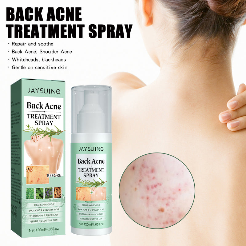 Back Acne Treatment Spray